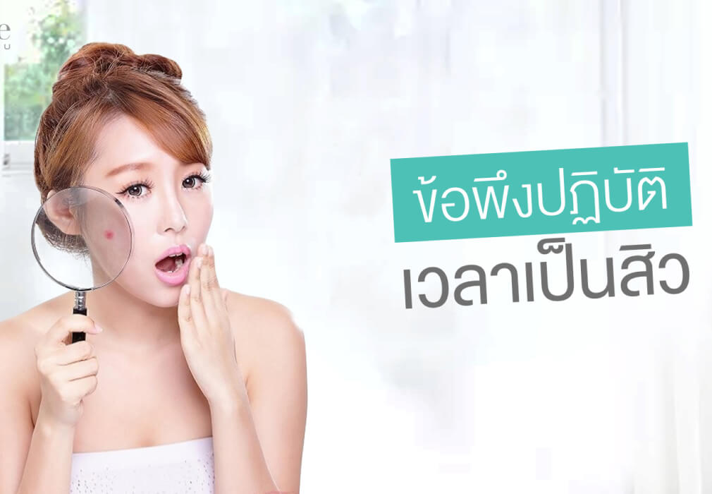 ข้อพึงปฏิบัติเวลาเป็นสิว  ข้อพึงปฏิบัติเวลาเป็นสิว